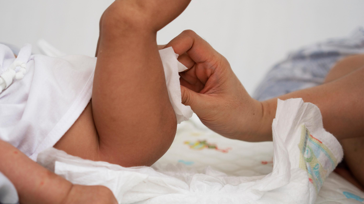 4 Easy and Natural Ways to Prevent Painful  Diaper Rashes